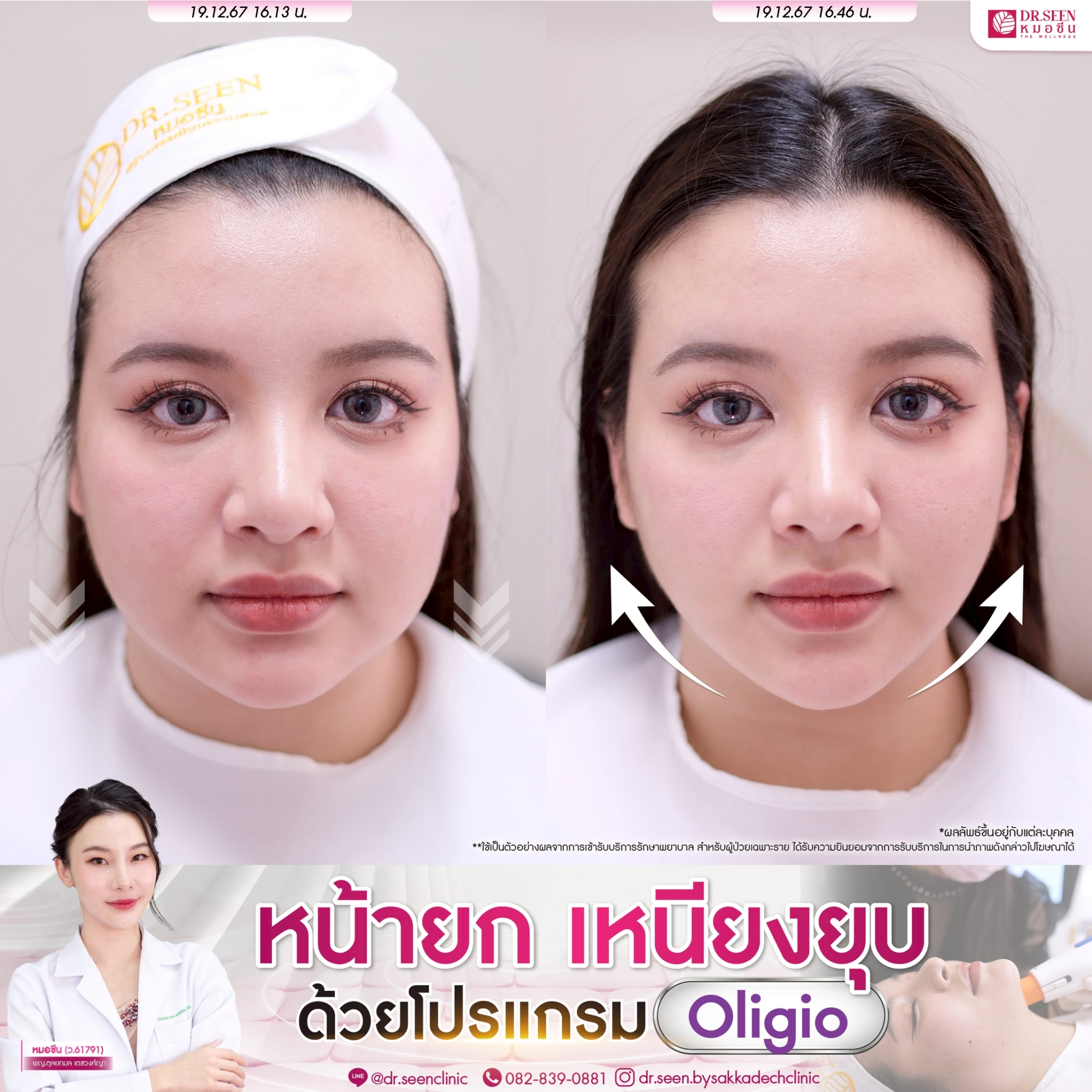 LINE_ALBUM_ความรู้ Oligio + รีวิว_250912_2