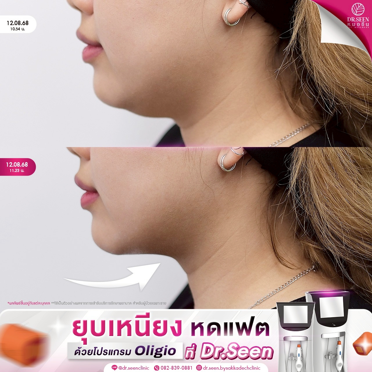 LINE_ALBUM_ความรู้ Oligio + รีวิว_250912_4