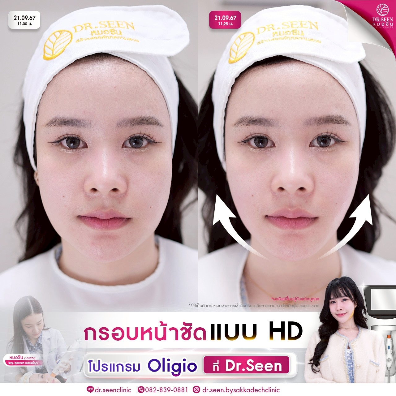 LINE_ALBUM_ความรู้ Oligio + รีวิว_250912_5