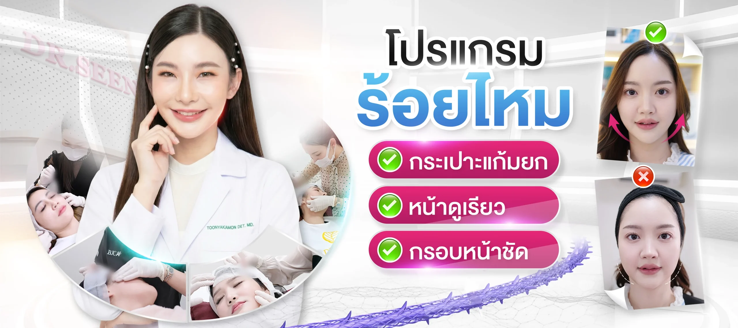 Banner - ร้อยไหมคืออะไร ช่วยอะไรได้บ้าง เเละมีผลเสียอะไรบ้าง? | Dr.Seen หมอซีน