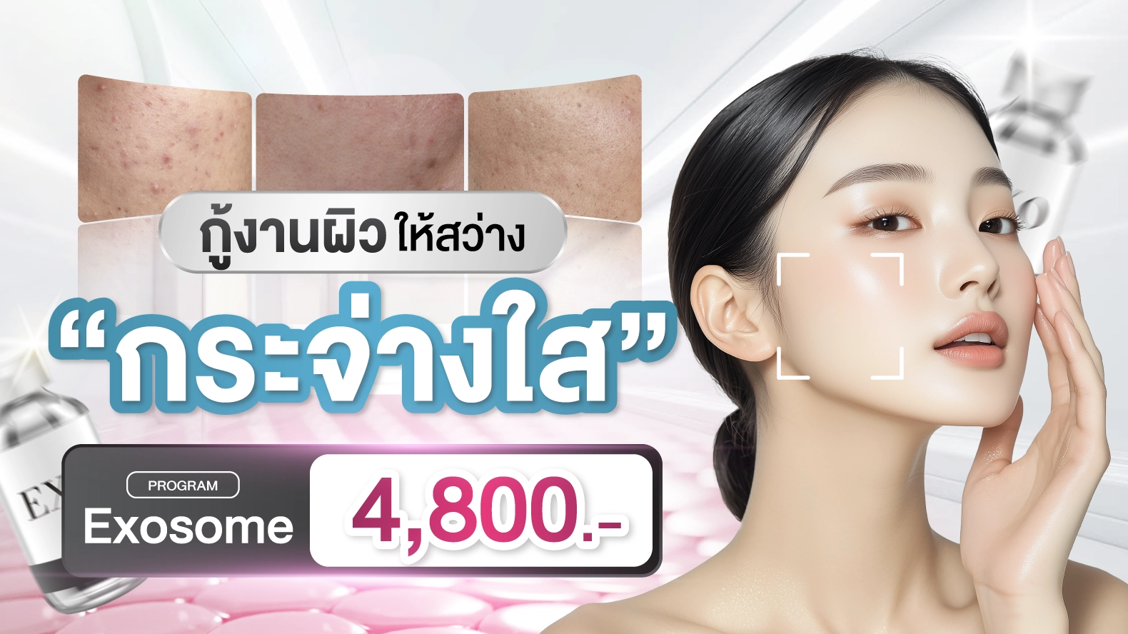 โปรexosome เว็บไซต์