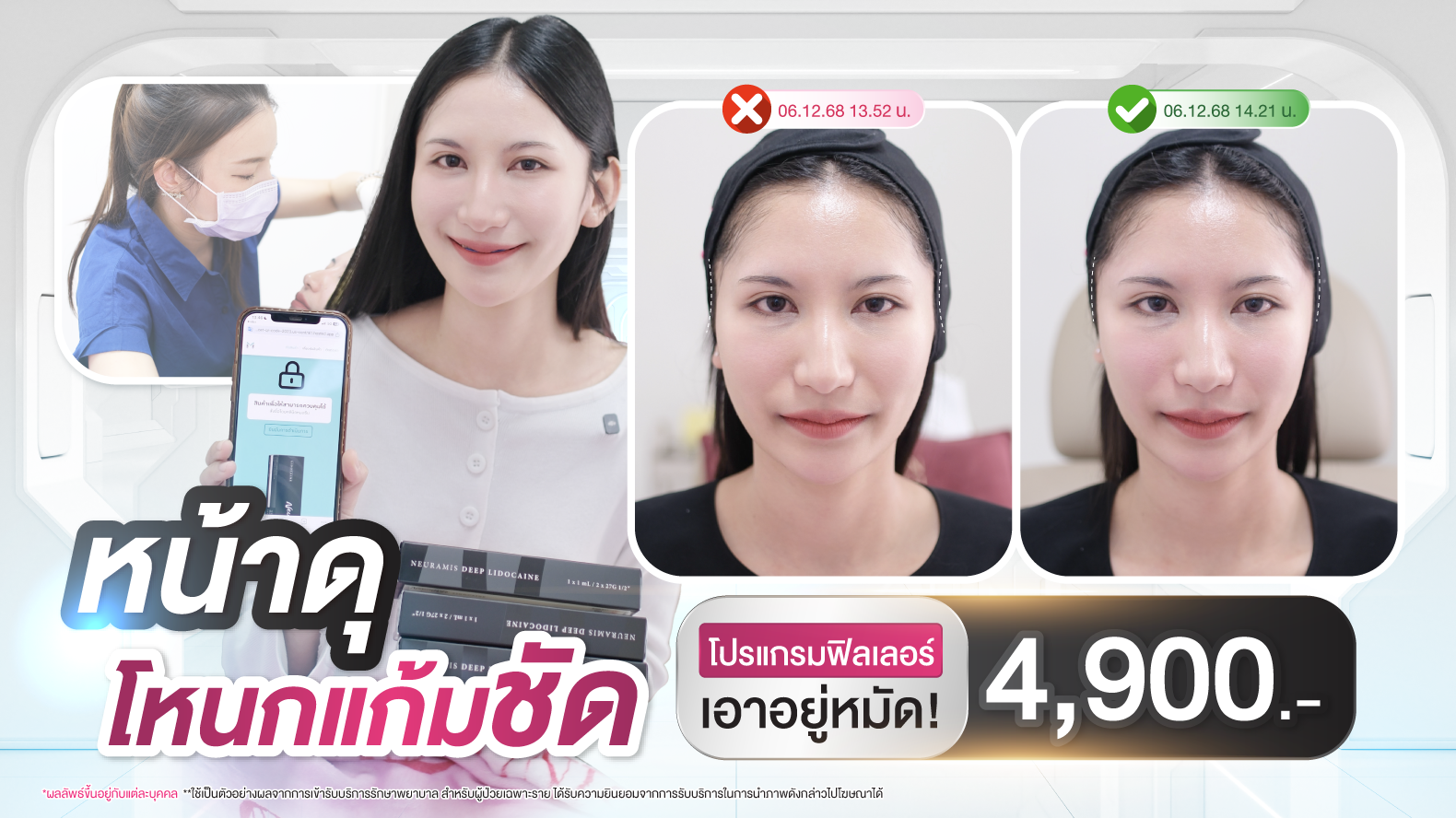 โปรฟิลเลอร์
