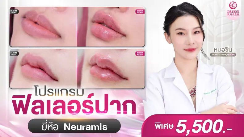 โปรแกรมฟิลเลอร์ปาก น่าKysse ที่ Dr.seen