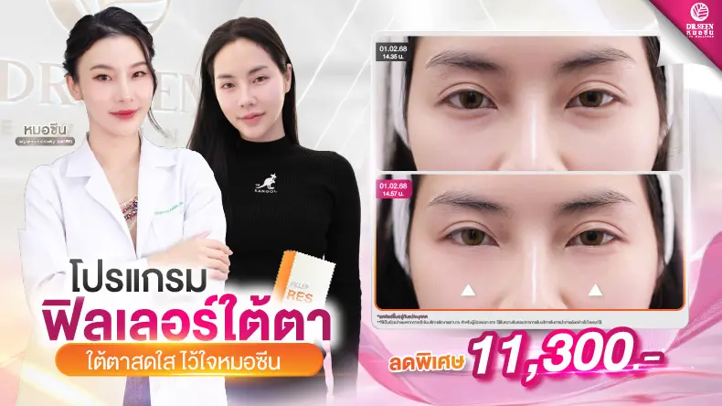 โปรแกรมฟิลเลอร์ใต้ตา ใต้ตาสดใส ไว้ใจหมอซีน