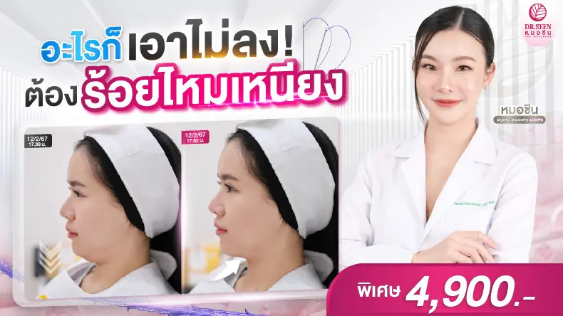 อะไรก้เอาไม่ลง! ต้องร้อยไหมเหนียง