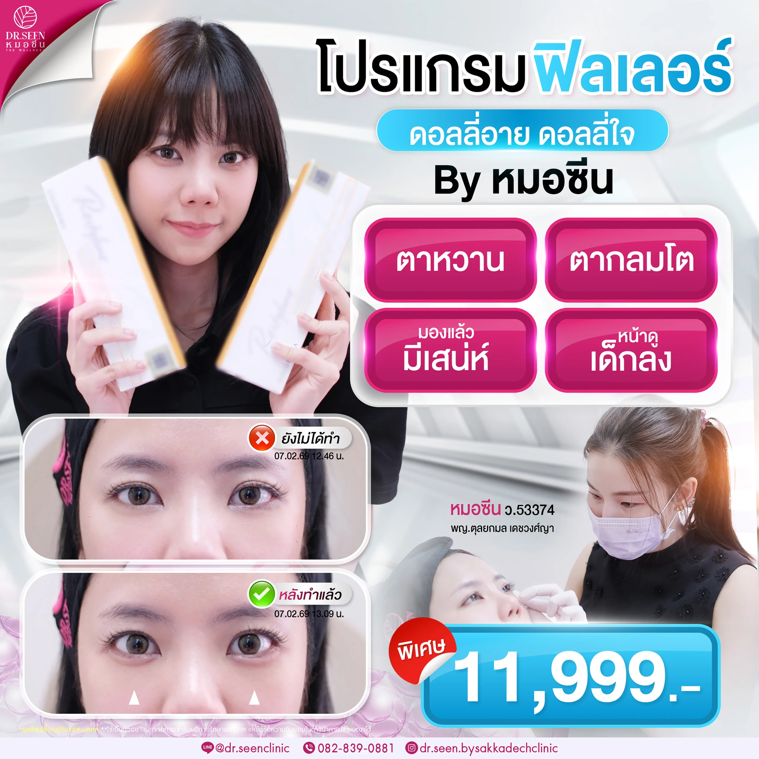 โปรดอลลี่