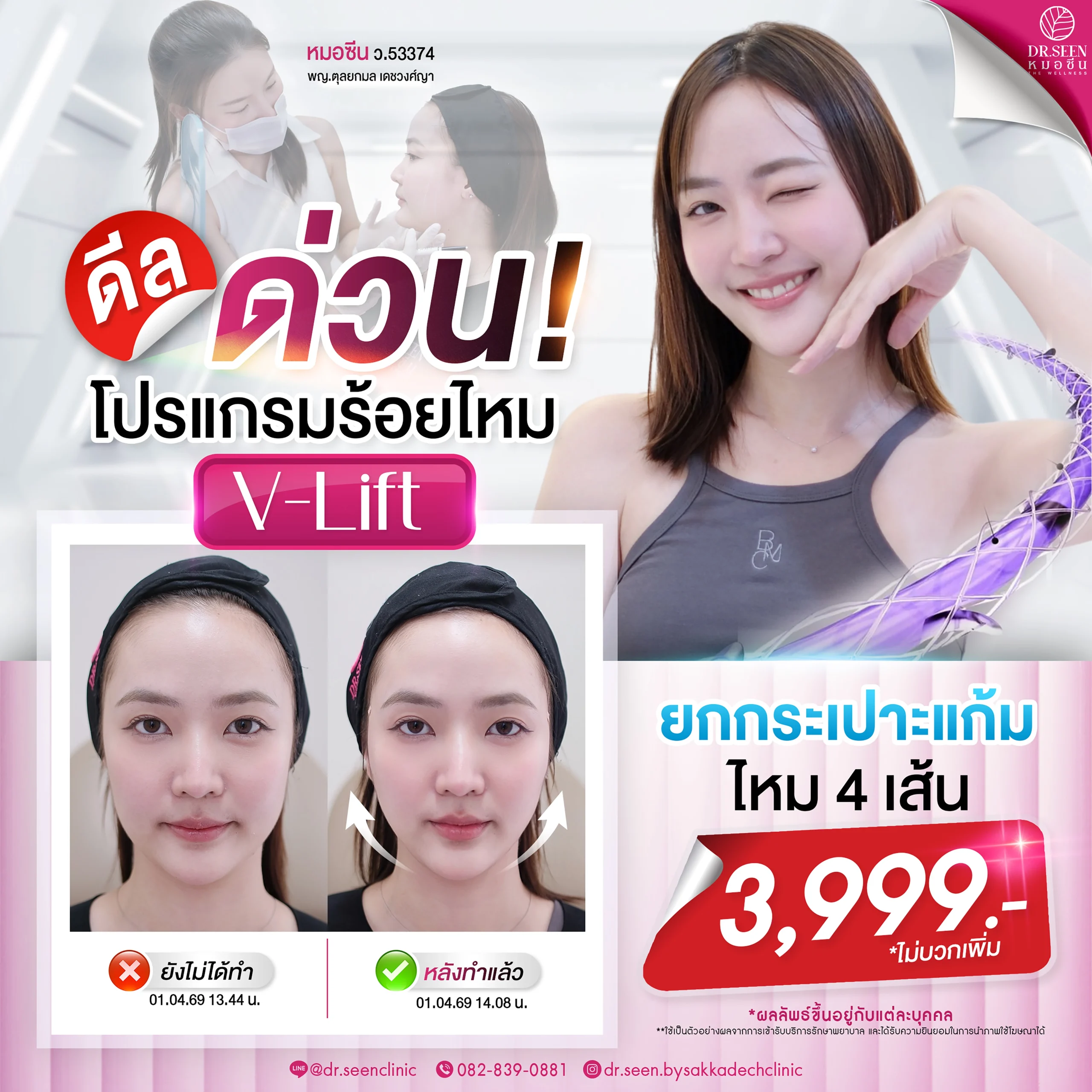 Dr.Seen หมอซีน by คลินิกเวชกรรมหมอสักกาเดช โปรร้อยไหม-V-lift