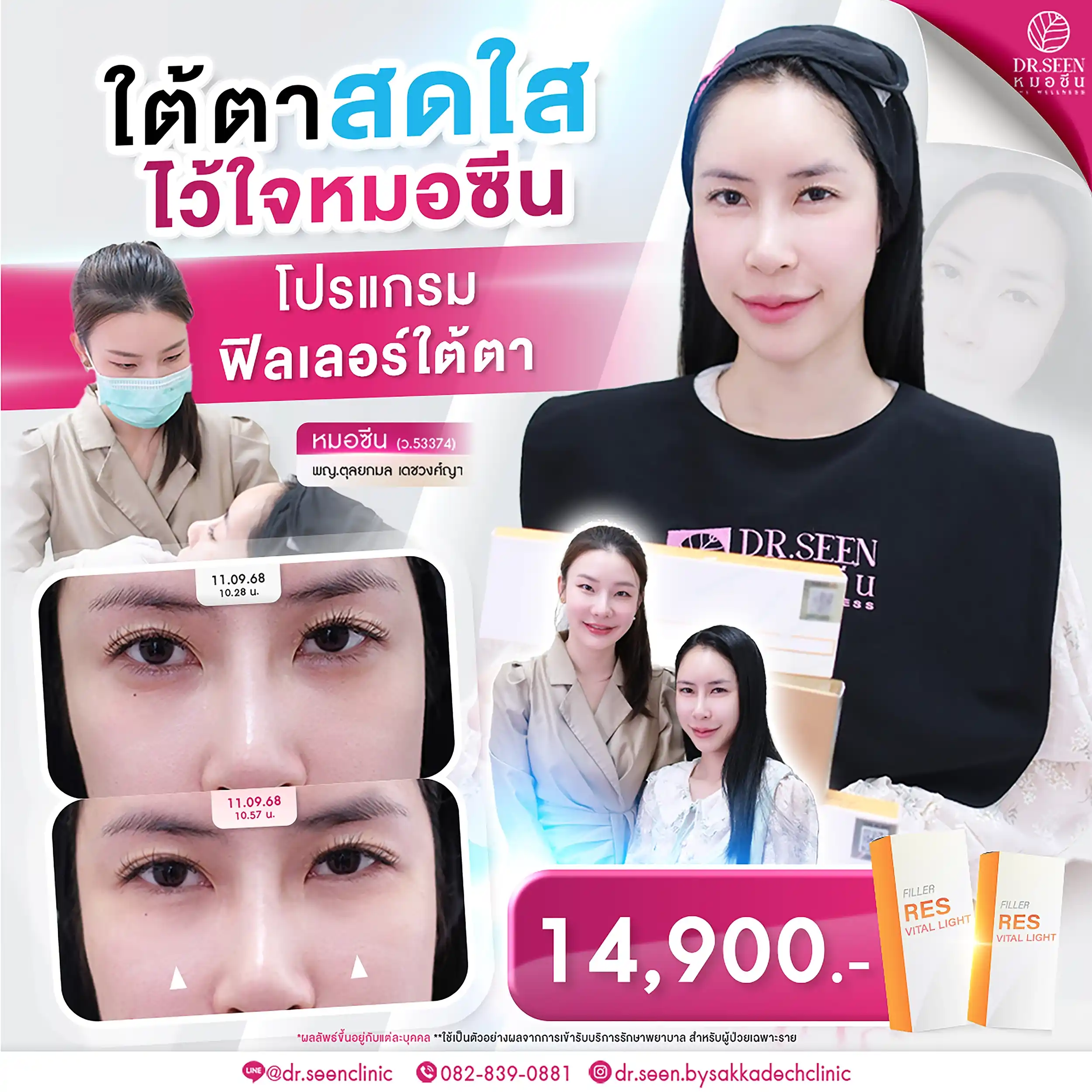 "โปรแกรมฟิลเลอร์ใต้ตา แก้ปัญหาใต้ตาคล้ำ เติมเต็มร่องลึก ให้ใต้ตาสดใส by Dr. Seen Clinic ราคา 14,900 บาท"