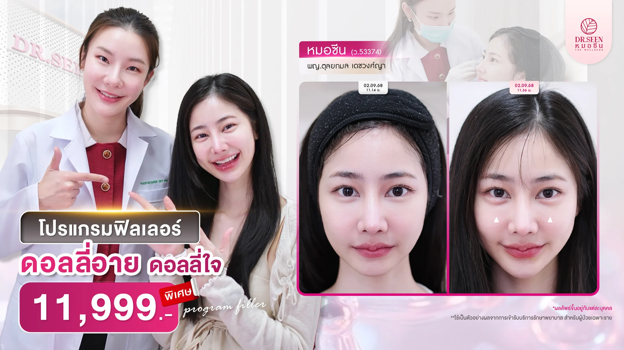 ภาพปกเเนะนำโปรโมชั่นสุดฮิตสำหรับโปรเเกรมฟิลเลอร์ ดอลลี่อาย - โดย Dr.Seen หมอซีน by คลินิกเวชกรรมหมอสักกาเดช