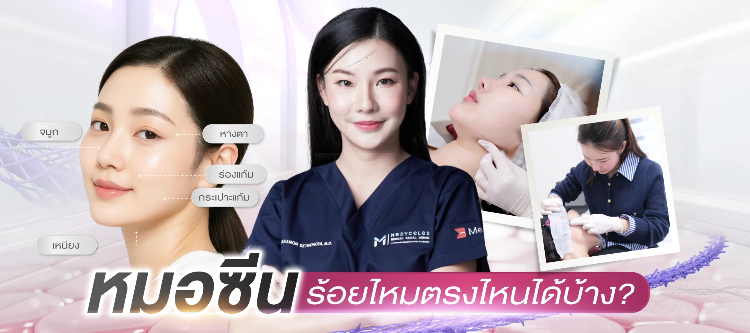 ร้อยไหมกับหมอซีน สามารถร้อยตรงไหนได้บ้าง อยากรู้หรือยังคะมาเริ่มกันเลย